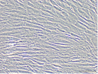 真皮線維芽細胞